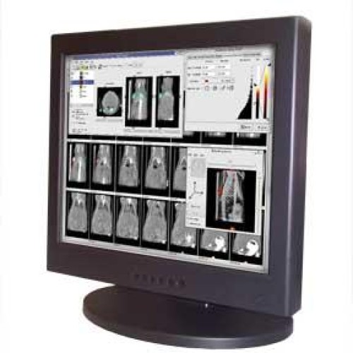 19inch high bright hd 1.3megapixel lcd medical display monitors